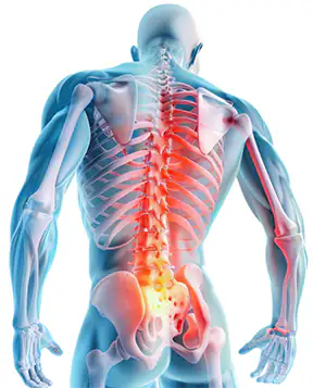 Illustration of Man with Spinal ain